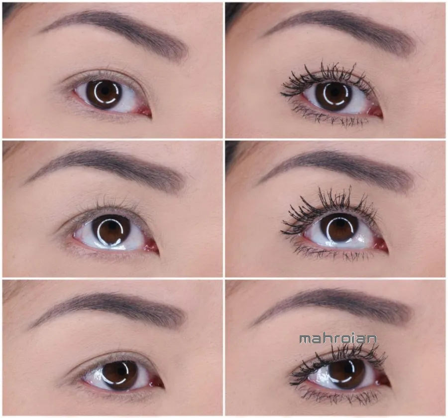 ریمل کلینیک