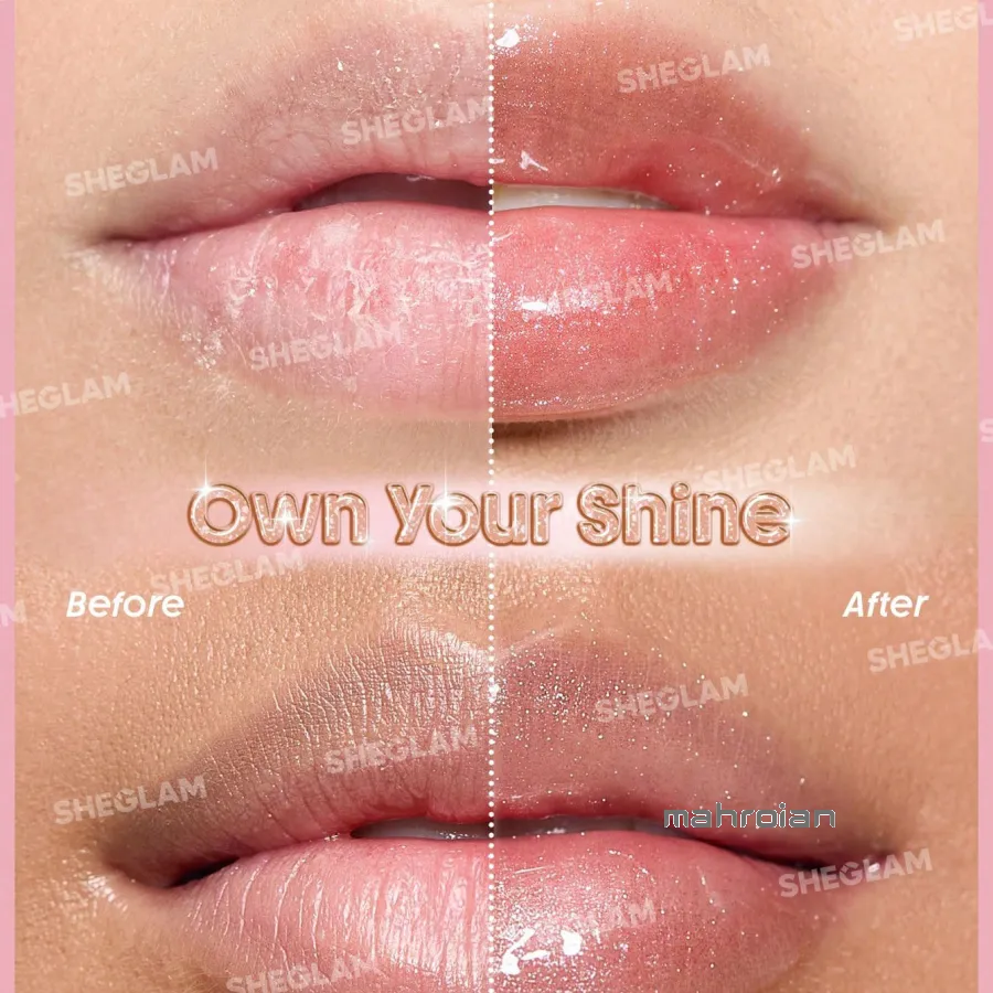 برق لب حجم دهنده شیگلم