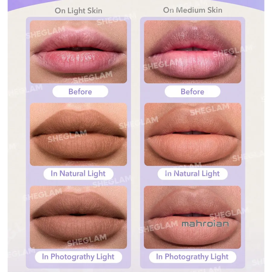 خط لب شیگلم