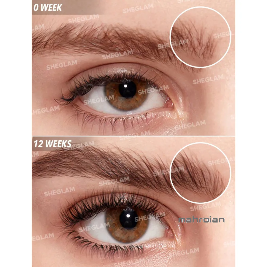سرم تقویت مژه و ابرو شیگلم