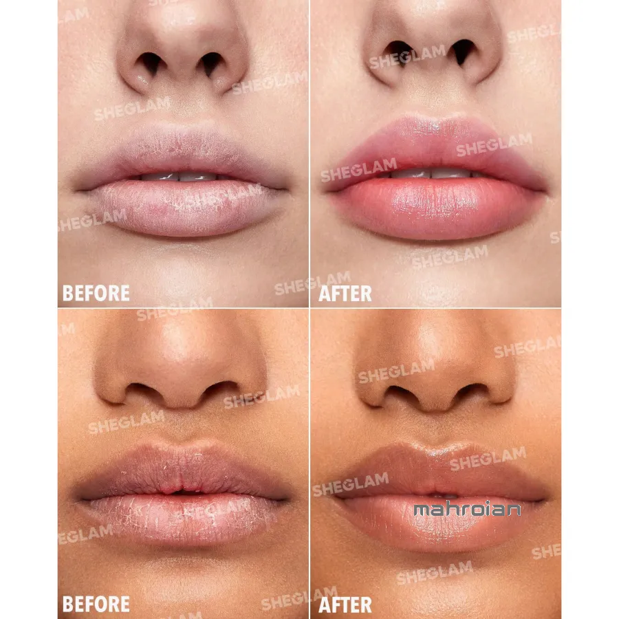 بالم لب مغذی شیگلم